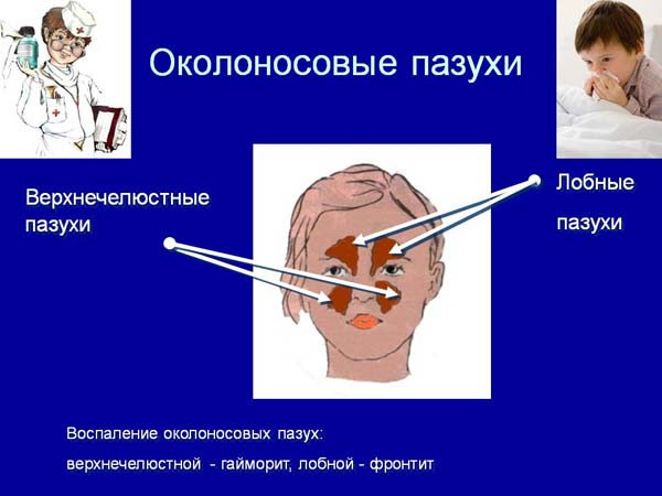 Околоносовые пазухи фото